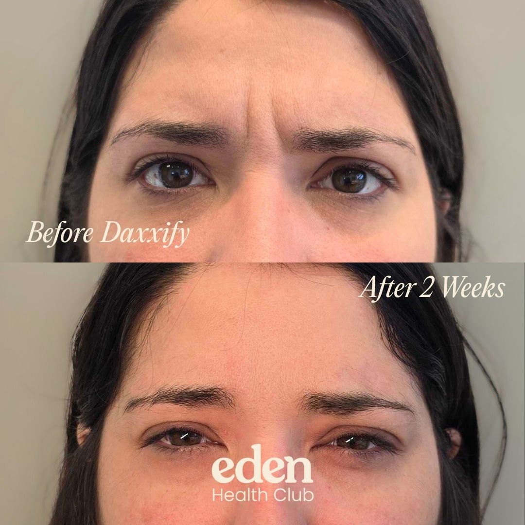 Image gallery marquee