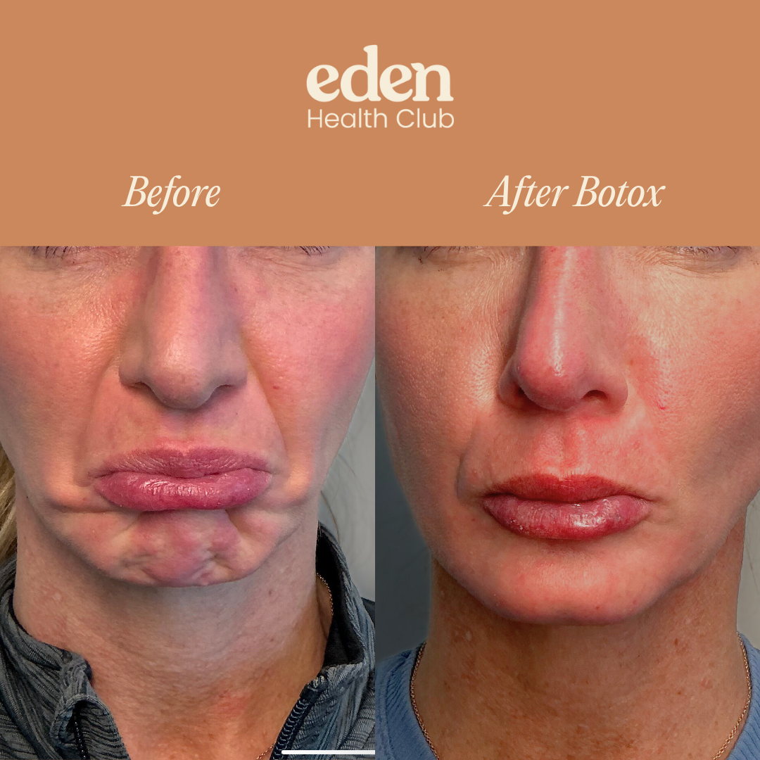 Image gallery marquee