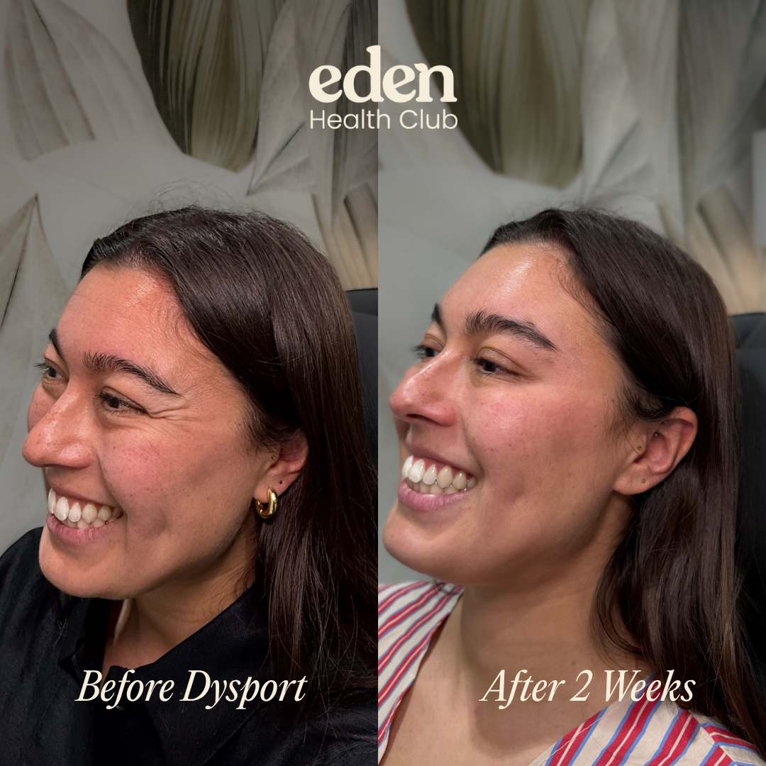 Image gallery marquee