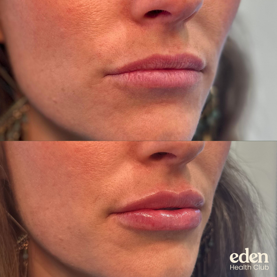 Image gallery marquee